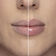LIP INJECTION 1.5GR